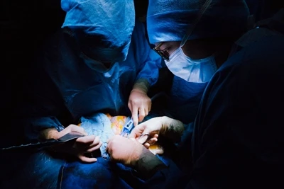 Hoch-Effizientes Schneiden für komplexe Orthopädie: Arthroskopische gezahnte ...
